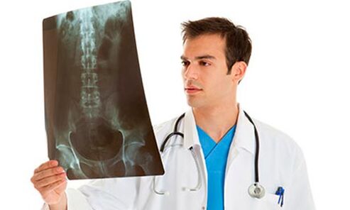 the doctor looks at an x-ray to diagnose low back pain